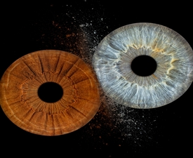 Turn your eyes into a unique picture with iris photography in Plovdiv - four irises in a frame