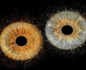 Превърнете вашите очи в уникална картина с ирисова фотография в София - заснемане на два ириса