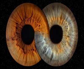  Ирисова фотография в Стара Загора – изкуство, скрито в очите - Заснемане на два ириса в рамка