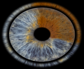 Превърнете вашите очи в уникална картина с ирисова фотография в София- заснемане на четири ириса в рамка