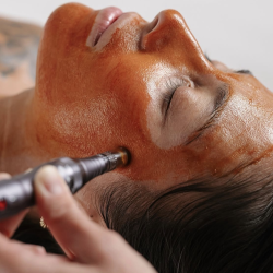 Терапия за лице с Дермапен за красива и стегната кожа в Стара Загора