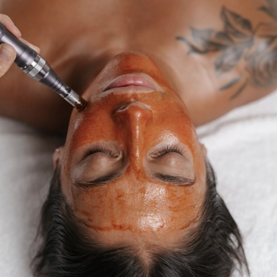 Погрижете се за кожата си с Терапия за лице с Дермапен за засилване на колаген и еластин в кожата от Makaroon Погрижете се за кожата си с Терапия за лице с Дермапен за засилване на колаген и еластин в кожата от Makaroon